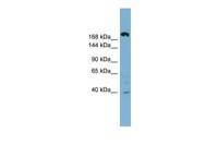 ABCC11 antibody, Internal