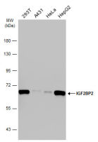 IGF2BP2 antibody