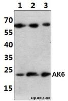 AK6 antibody