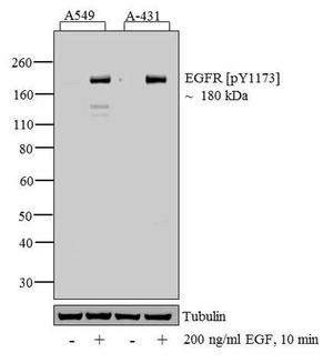 EGFR (phospho Tyr1086) antibody