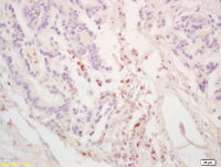 GGNBP2 antibody
