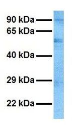 CASD1 antibody, N-term