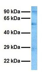 CASD1 antibody, N-term产品图