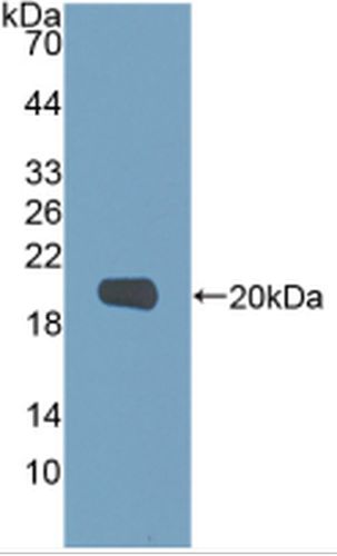 Human MMP9 protein, His tag (Active)