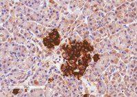 CCKAR antibody, Internal