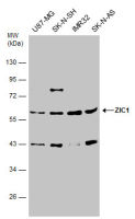 ZIC1 antibody