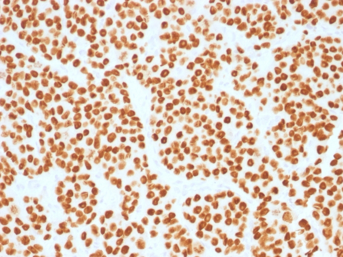 FOXA1 antibody [FOXA1/1515]