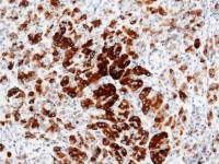 REG III alpha antibody [019]