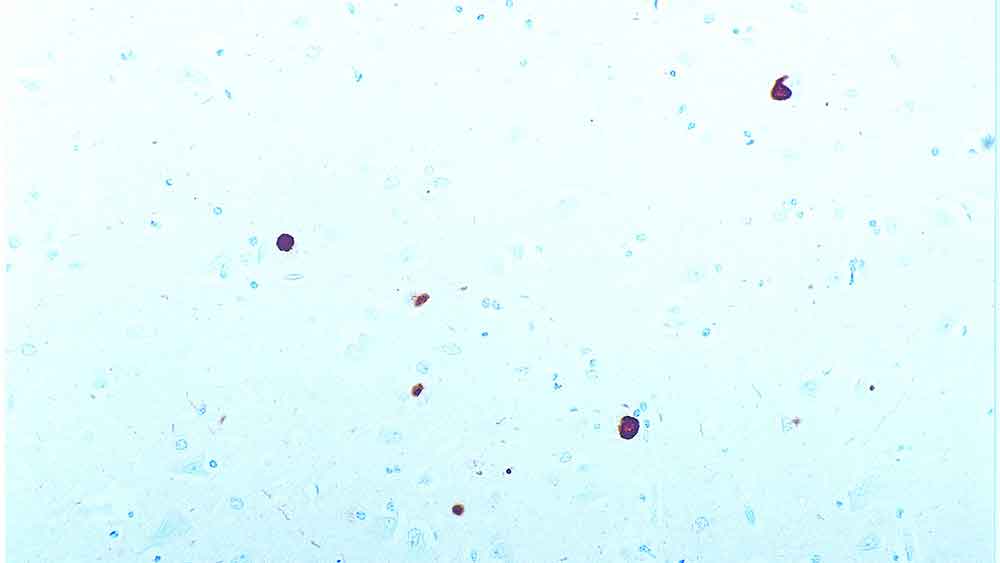 alpha Synuclein antibody [KM51]