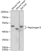 Pepsinogen II antibody