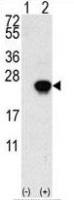 FGF1 antibody, N-term