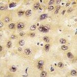 PROX1 antibody, Internal