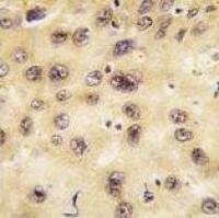 PROX1 antibody, Internal