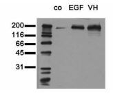 EGFR (phospho Tyr1173) antibody [9H2]