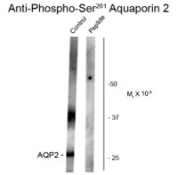 Aquaporin 2 (phospho Ser261) antibody