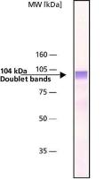 gamma Adaptin antibody [100/3]