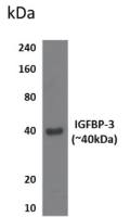 IGFBP3 antibody [11B16]