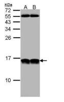 NHP2L1 antibody [N1C3]