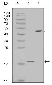 Survivin antibody [2H5H2]