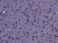 LRRK2 (near C Terminus) antibody, Internal