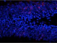 ERK1 (phospho Thr202/Tyr204) + ERK2 (phospho Thr185/Tyr187) antibody