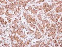 MAGEA4 antibody