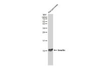 Insulin antibody [GT1229]