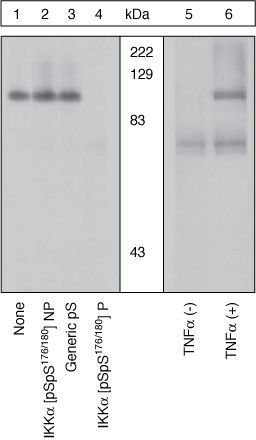 IKK alpha (phospho Ser176/Ser180) antibody