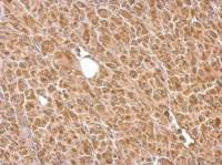 Hexokinase II antibody