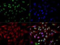 CITED2 antibody [JA22]