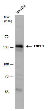 ENPP1 antibody [N2C2], Internal