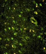 KHSRP antibody, N-term