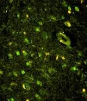 KHSRP antibody, N-term