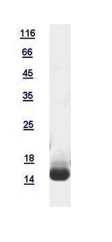 Human RBP1 protein, His tag