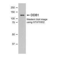 DDB1 antibody [1322]