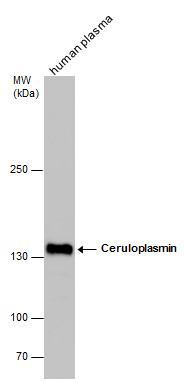 Ceruloplasmin antibody