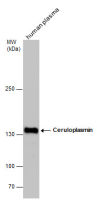 Ceruloplasmin antibody