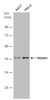Hepsin antibody