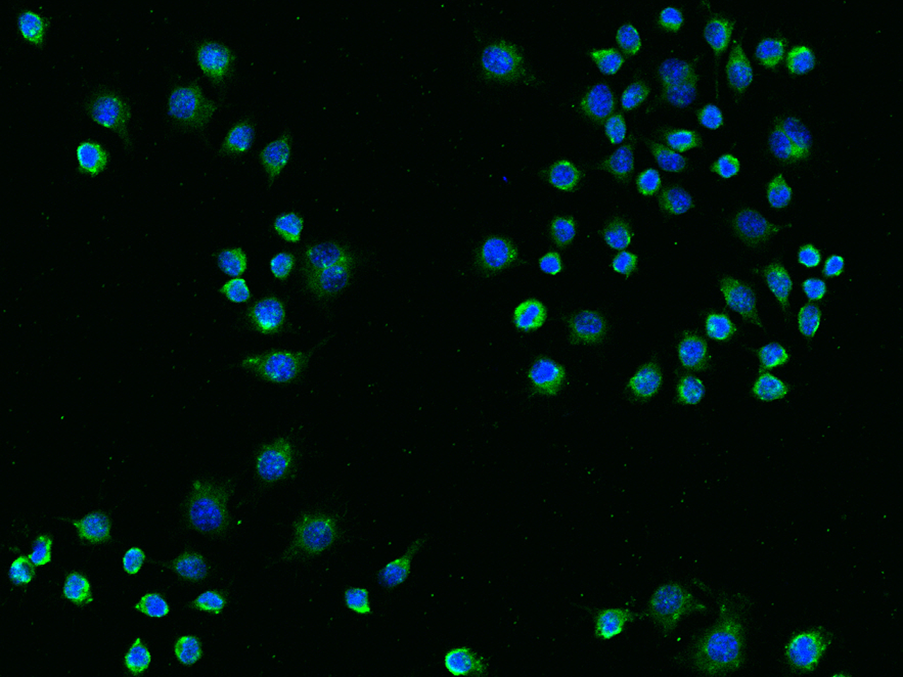 TREM2 antibody [014]
