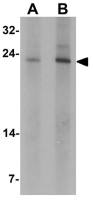 TCTP antibody
