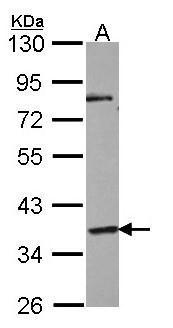 GPR45 antibody
