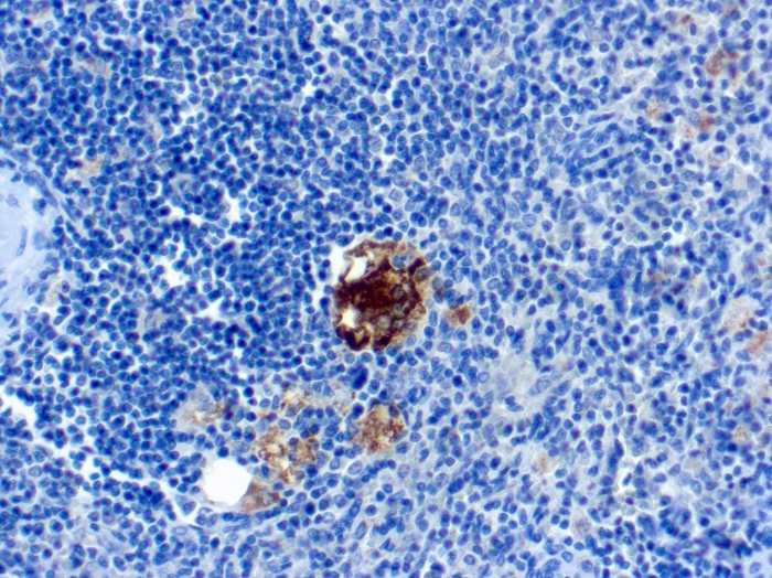 TRAP antibody [SPM601]