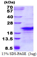 Human RPL26L1 protein, His tag