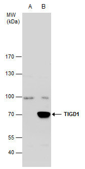 TIGD1 antibody [C3], C-term