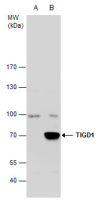 TIGD1 antibody [C3], C-term