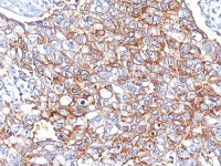 EpCAM antibody [PAN-EpCAM (Cocktail)]