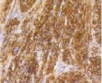 Caldesmon antibody [GT1108]