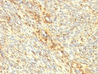 Transglutaminase 2 antibody [TGM2/419]