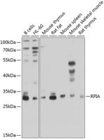 RPIA antibody