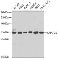 SNAP29 antibody